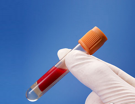 高血脂，隱秘的溫柔殺手