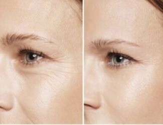 提前衰老、抵抗力差，用熟三七粉，抗衰還能補(bǔ)氣血！